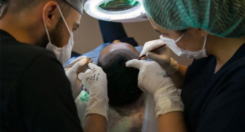 Hybrid Hair Transplant